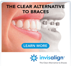 Invisialign Alternative to Braces